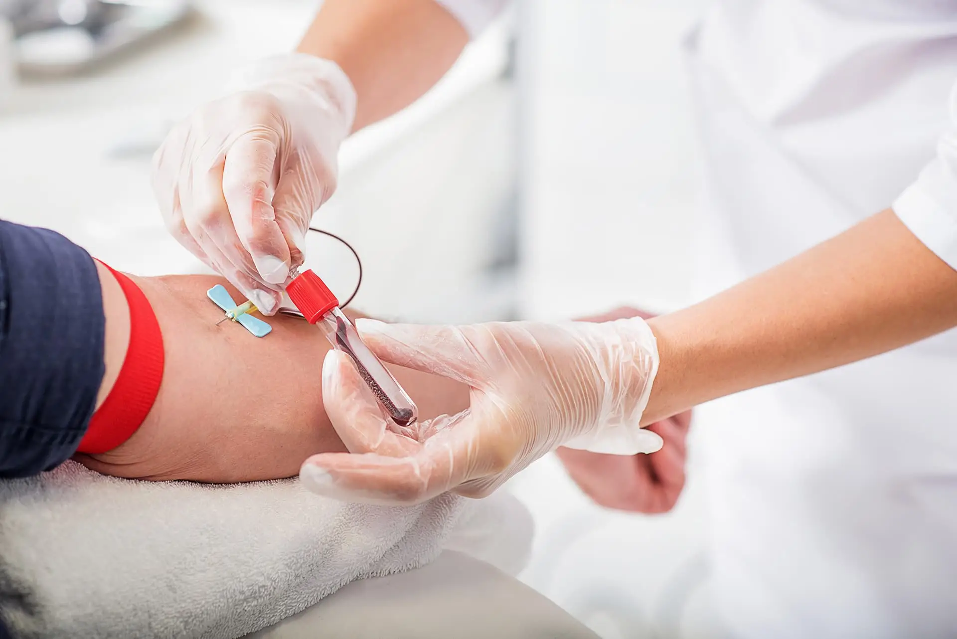 Guida alle analisi del sangue: ecco l’elenco più utile per il check up completo