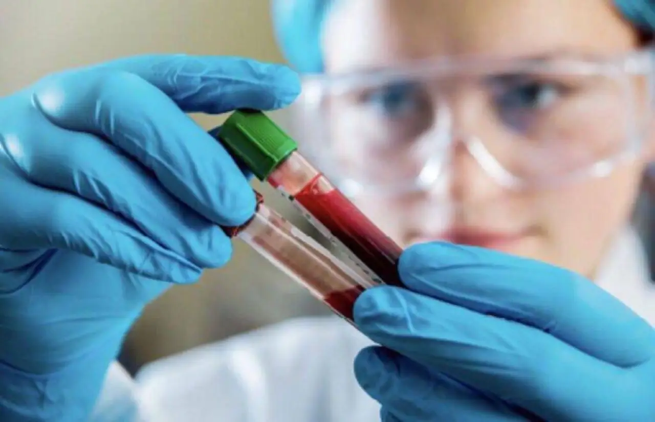 Hai fatto le analisi del sangue? Ecco quando puoi richiedere il rimborso e come fare