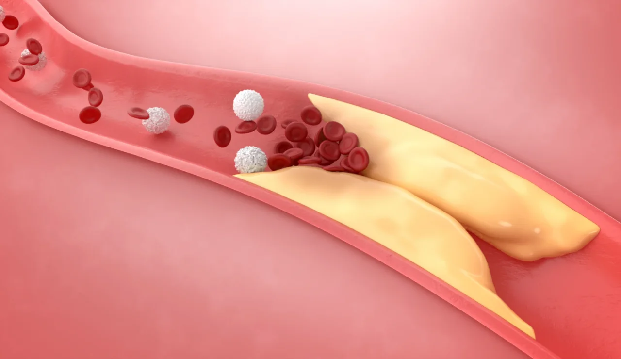 Vene o arterie? Ecco la differenza cruciale e come capire se hai un problema